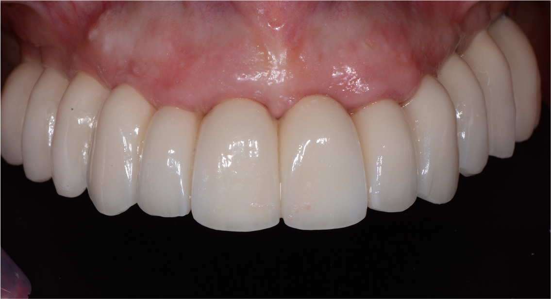 After image