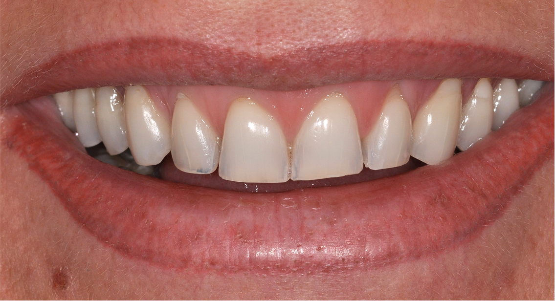 Before image