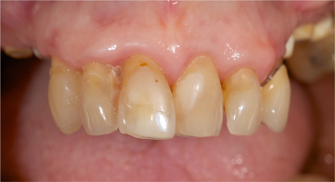 Before image