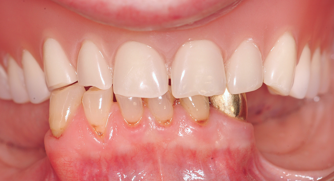 Before image