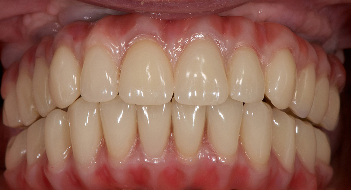 After image